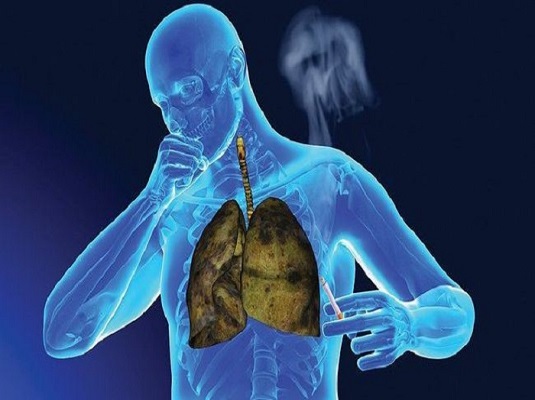 Nghiên cứu mới: Ô nhiễm không khí có thể gây đột biến DNA dẫn đến ung thư phổi ở người không hút thuốc